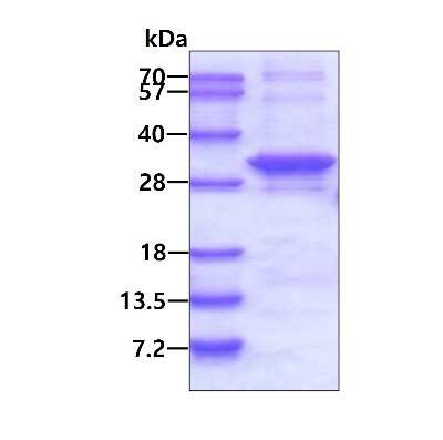 SDS-PAGE Recombinant Human ARMC10 His Protein